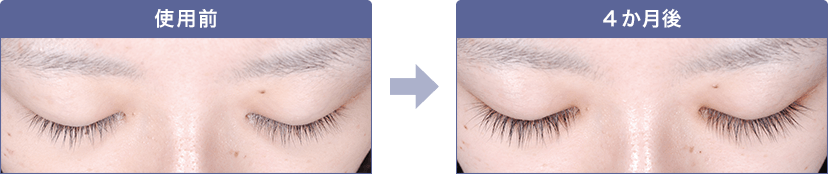 グラッシュビスタの効果が認められた代表例