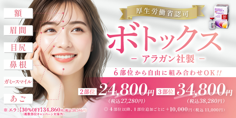 厚生労働省認可 ボトックス -アラガン社製- 鼻根 眉間 目尻 額 ガミースマイル あご 6部位から自由に組み合わせOK!! 2部位24,800円（税込27,280円） 3部位34,800円（税込38,280円） ※4部位以降、1部位追加ごとに＋10,000円（税込11,000円） ※エラ：【30％OFF】34,860円（税込38,346円）（複数部位キャンペーン対象外）