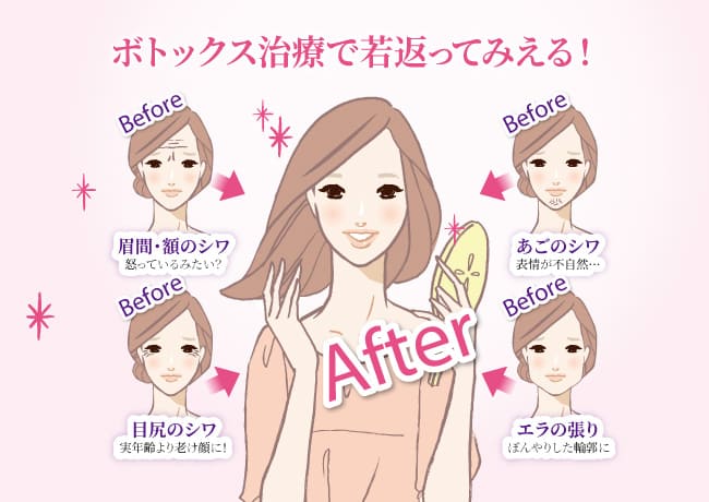 眉間や額、目尻などの表情シワを軽減小顔効果や汗腺の活動も抑制